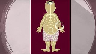 How does anesthesia work? - Steven Zheng