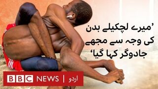 Contortionist: 'Because of my flexible body, they called me a witch.' - BBC URDU