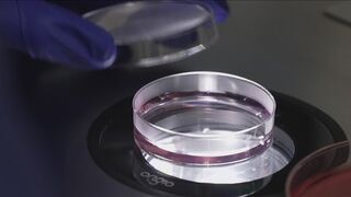 Things to know about fertility treatments: Costs, employer fertility benefits and more