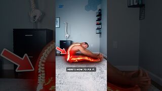 STOP Stretching Your Sciatica!
